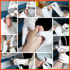 Medizinische Fußpflege - Foot care - Chiropody