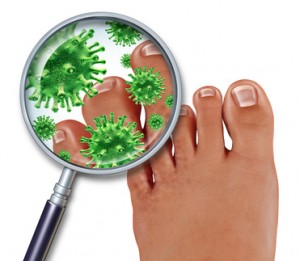 Foot Fungus Foot Fungus